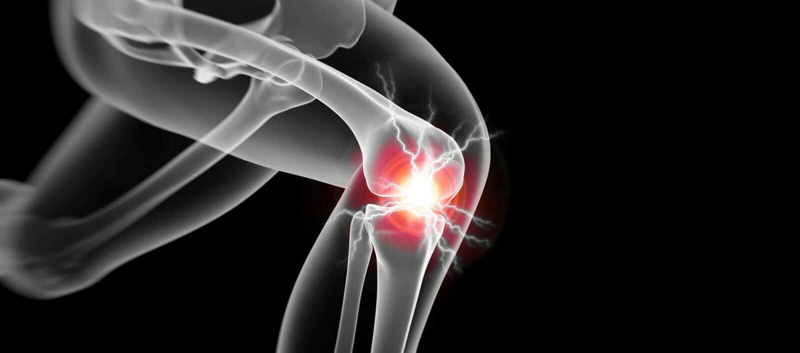 Traitement des pathologies des genoux à Paris: Arthrose - Lésion méniscale - dr Paillard