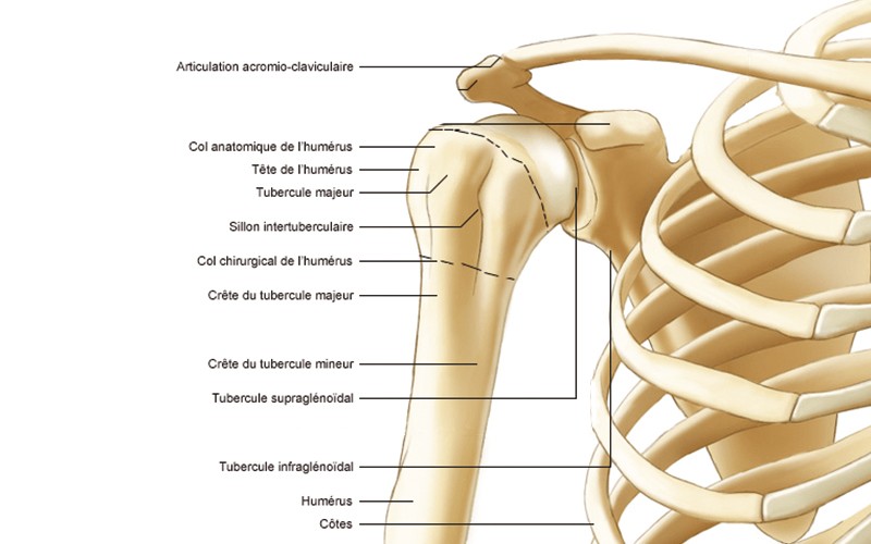 Gros Plan Sur Une épaule Féminine Avec Une Cicatrice Après L'installation  Chirurgicale D'une Fracture Osseuse Sur Plaque Métallique