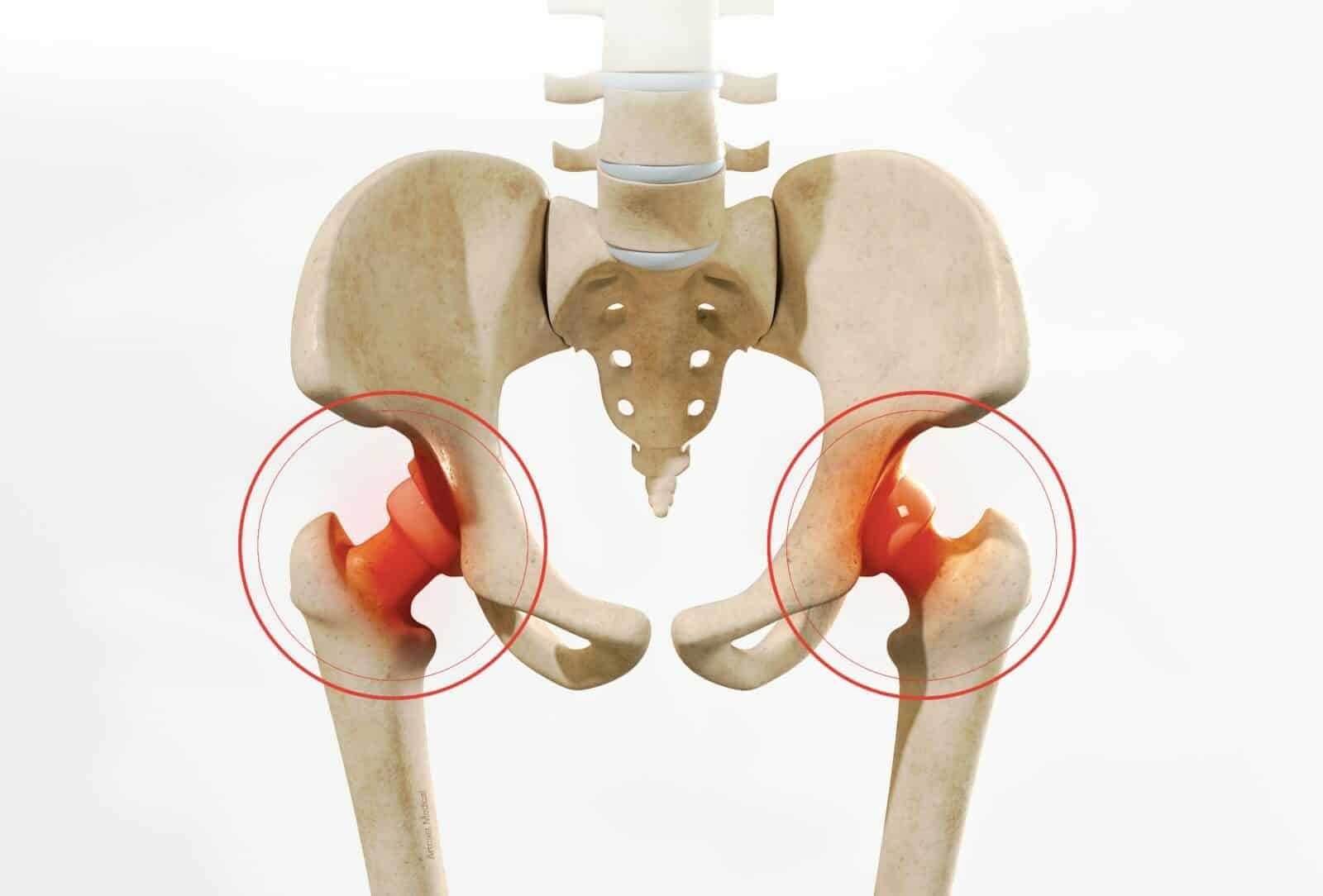 Chirurgie conservatrice de la hanche à Paris - docteur Paillard, Chirurgien orthopédique