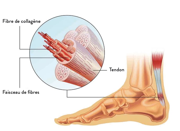 Symptômes et diagnostic de la tendinite du talon d'Achille | Dr ...