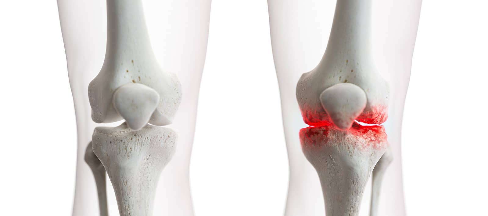 Comment savoir si on a un problème au genou ? | Dr Paillard