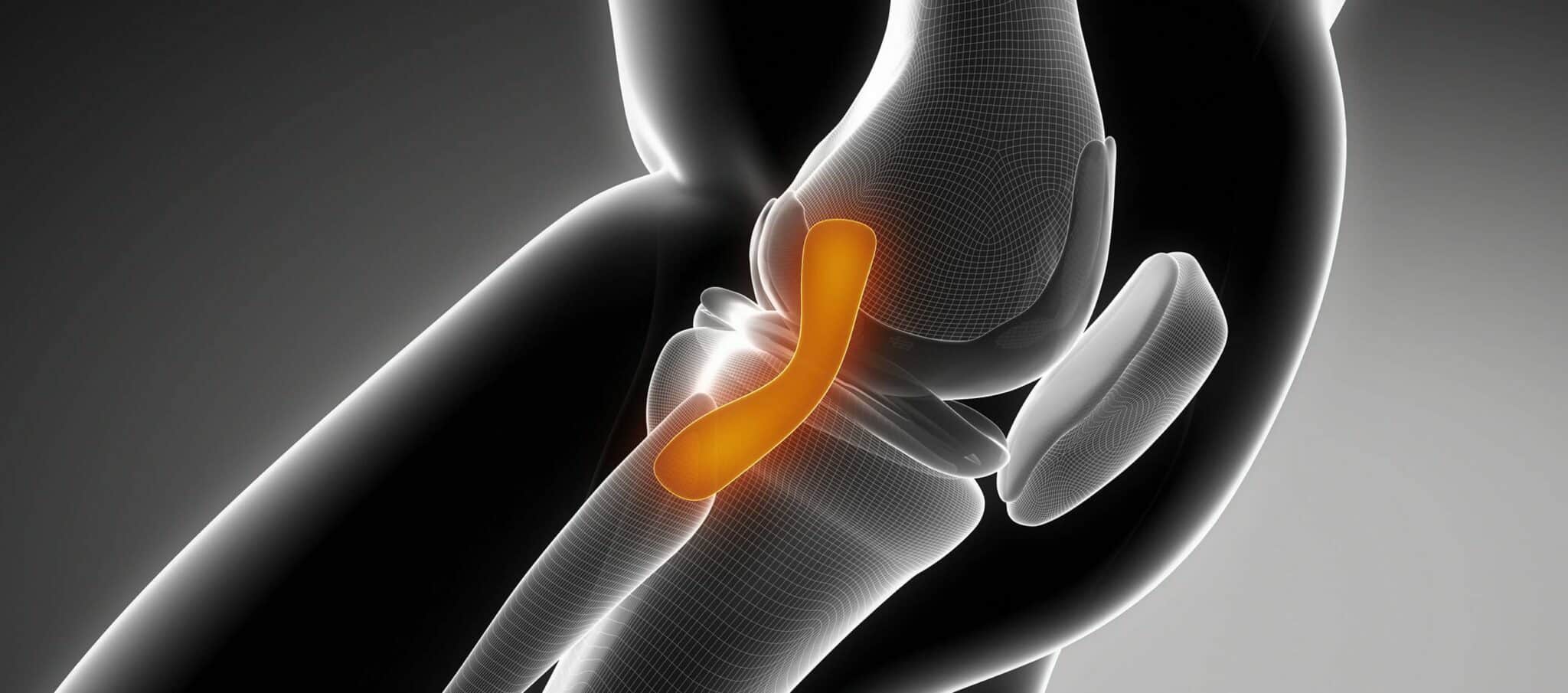 Conduire après une ligamentoplastie, informations sur la rééducation | Dr Paillard
