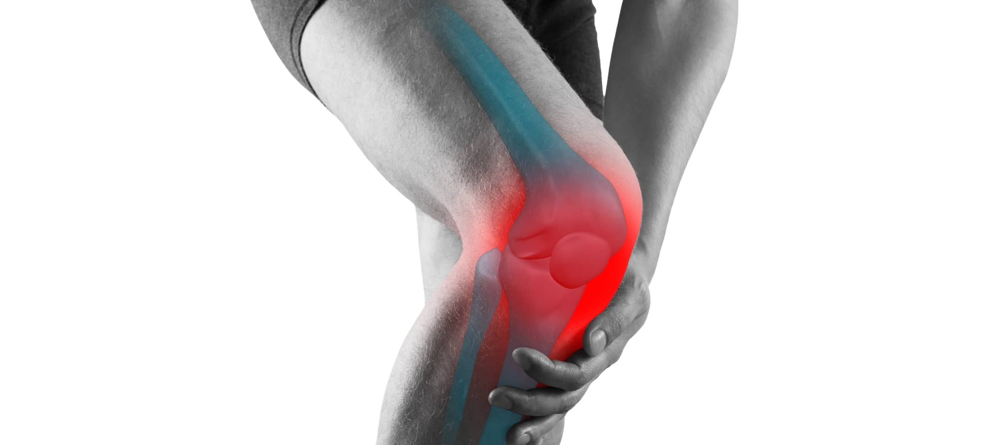 Comment soulager l'arthrose du genou ?, Dr Paillard