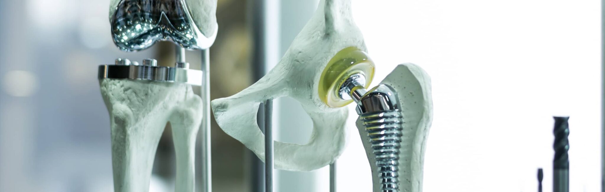 Dans quels cas doit-on réopérer une prothèse de genou ? | Dr Paillard | Paris